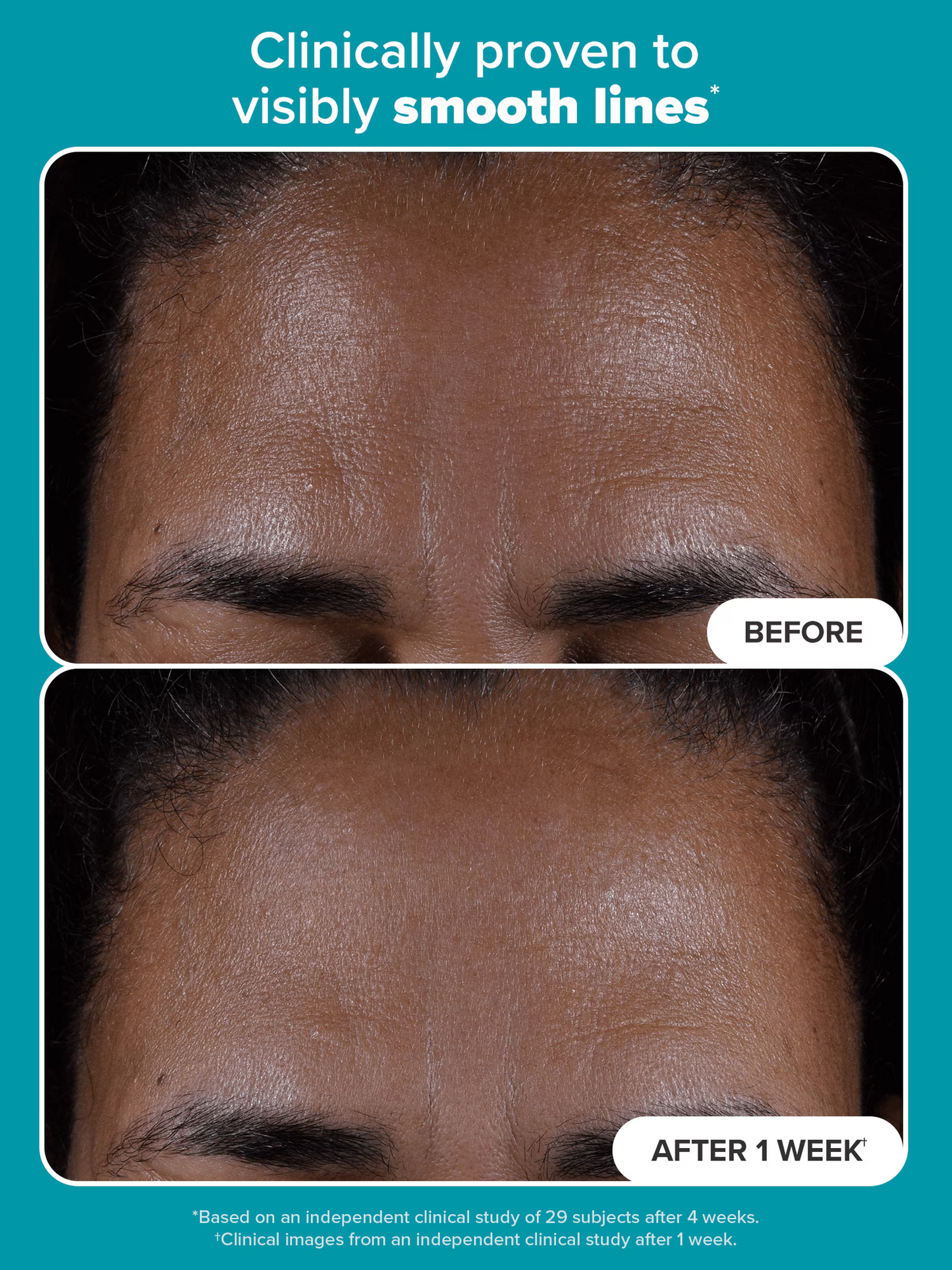 2% BHA Liquid Exfoliant