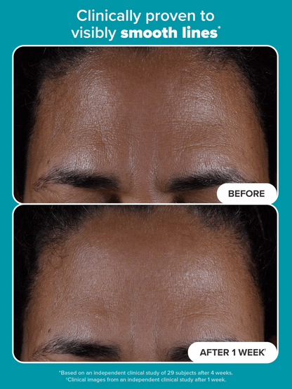 2% BHA Liquid Exfoliant